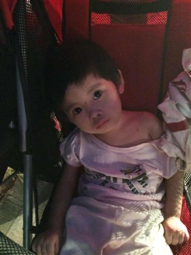 被遗弃女童 身上多处蚊虫叮咬