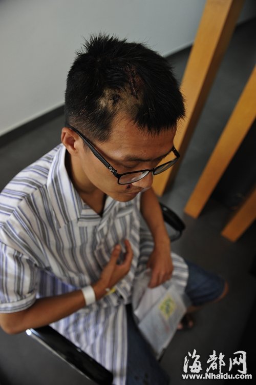 小郑头部被划出两道口，对此至今还心有余悸
