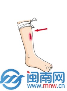 蛇咬1