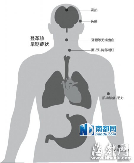 登革热症状