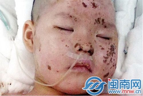 ICU悬浮床与背部摩擦，妞妞很疼，难得睡上一个安稳觉