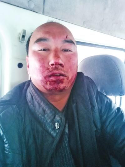 倪志国被打之后的照片