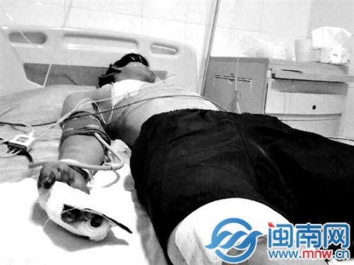 陈晓平被砍得浑身是伤
