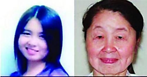 28岁女子生孩子后变老太婆 皮肤松弛怪病求助整形