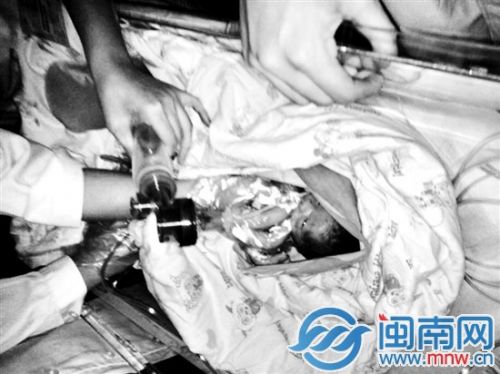 早产的安安患有急性坏死性小肠炎