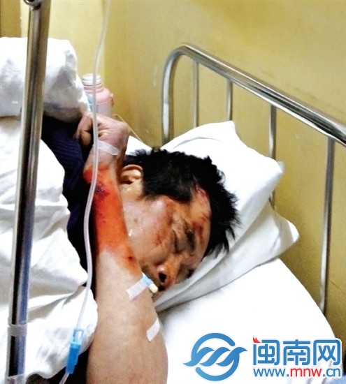 浼よ&euro;呴檲鏌愭按韬綋澶氬楠ㄦ姌