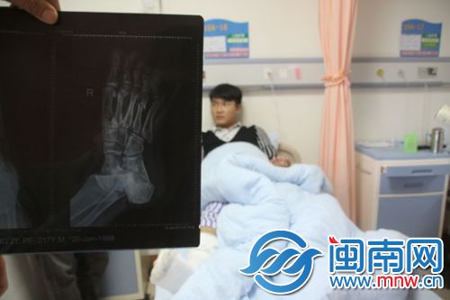 小王脚趾粉碎性骨折