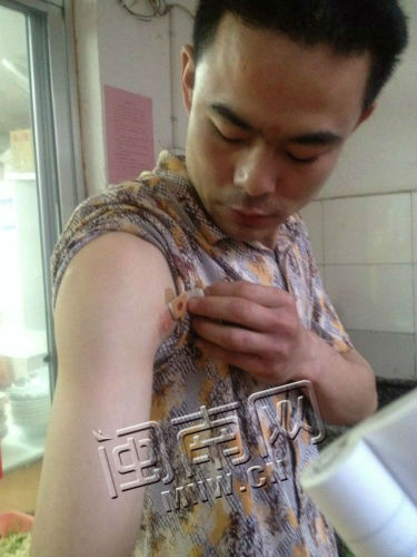 李先生的右臂被扎破一个小伤口