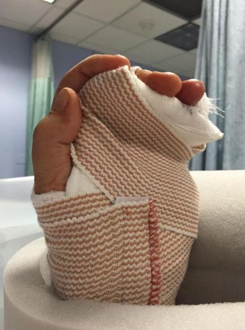 婚戒变成人间凶器! 美国主持人被戒指扯断手指(图)-闽南网