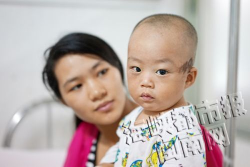 小男孩左脑被车轮擦伤的地方已经结痂