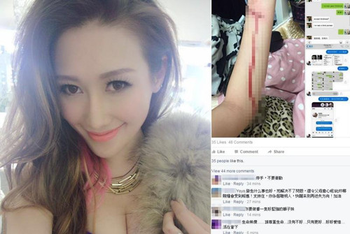 香港嫩模 伍淑怡 YoYo疑陷裸照风波欲自杀 晒割