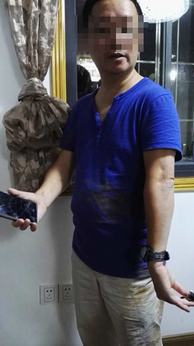 缪先生身上多处擦伤，手机也摔坏了