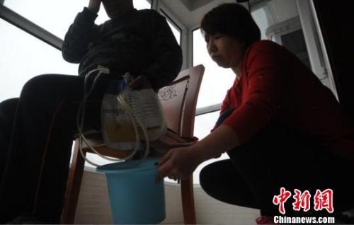 很多時(shí)候，申建軍（化名）需要女兒的幫忙，來排盡尿袋?！『　z