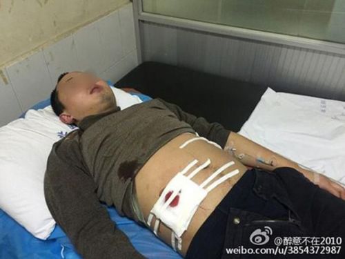 事发后,伤者亲属在微博发帖爆料,图为伤者图片。 @醉意不在2010 图