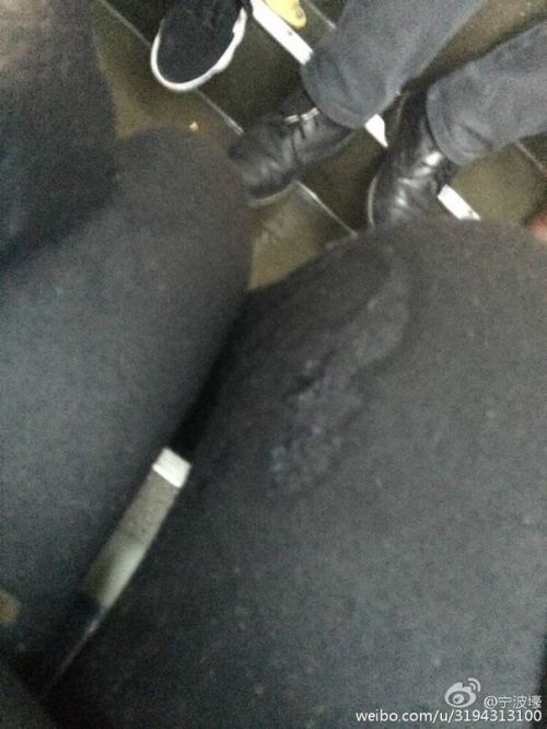 小A突然发现，自己的大腿裤袜上湿乎乎的，有不明液体