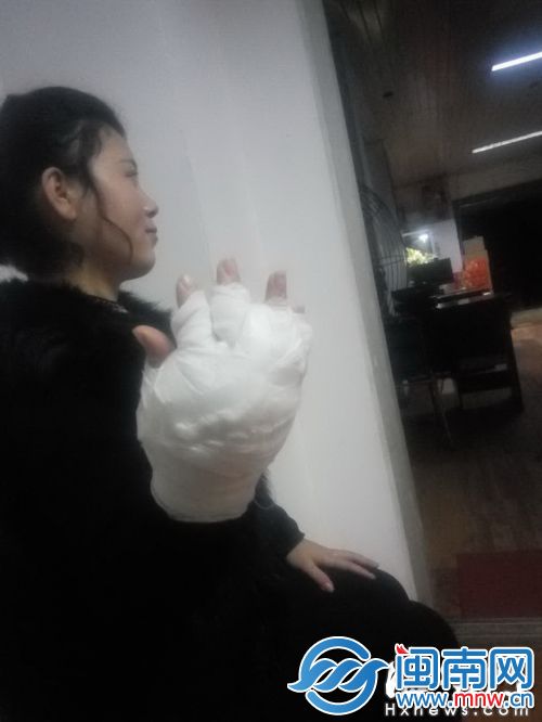 跳楼逃生的小余只是右手被烧伤（小余供图）