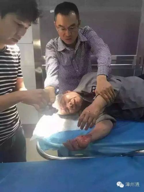 保安大伯在医院接受治疗