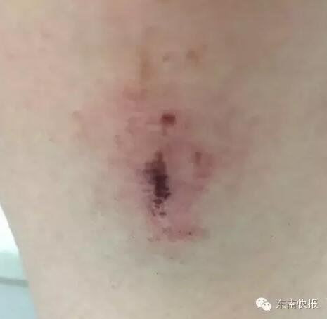 猥琐男子突然拿东西砸她头