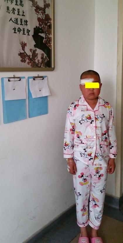 颅咽管瘤安区术后反应 我就是做完手术之后再重症监护