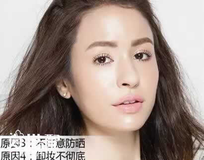 皮肤暗黄的原因及皮肤变白办法-闽南网