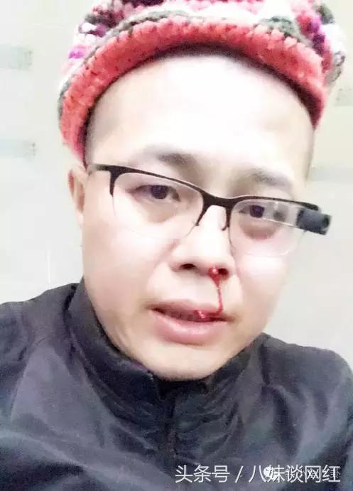 斗鱼tv知名主播首富户外被揍 任成超鲜血淋漓!