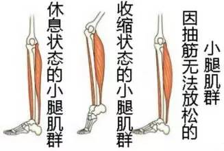 然而,很多人在跑步时常会突然抽筋,尤其是在长距离,高强度奔袭的