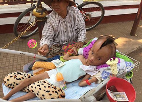 男孩脑袋长裂缝：已有10厘米深 随年龄增长变宽变深