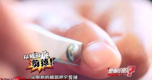 4岁女孩拔了根倒刺被截指 这个习惯很多人都有