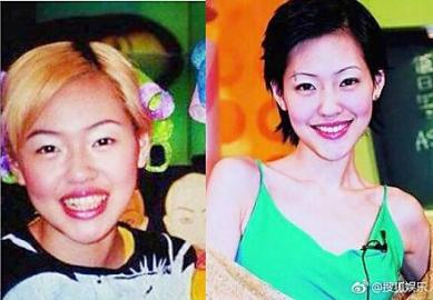 看看牙有多重要孙杨一整变王凯