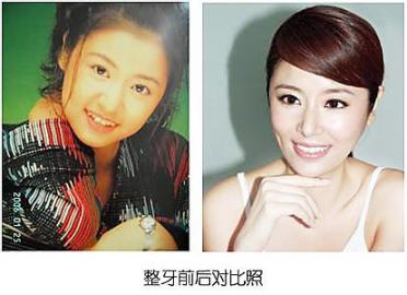 看看牙有多重要孙杨一整变王凯