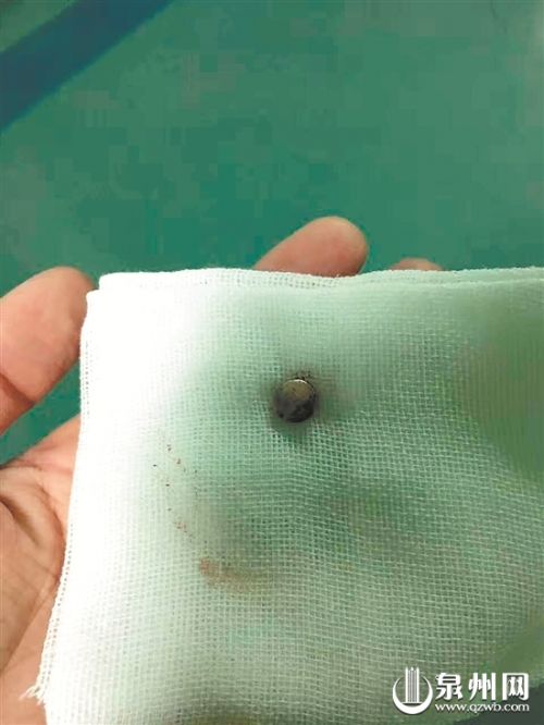 取出的纽扣电池