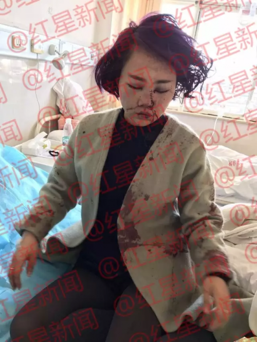 麗江被打女孩果真近照 圖 麗江被打女孩遺書全文