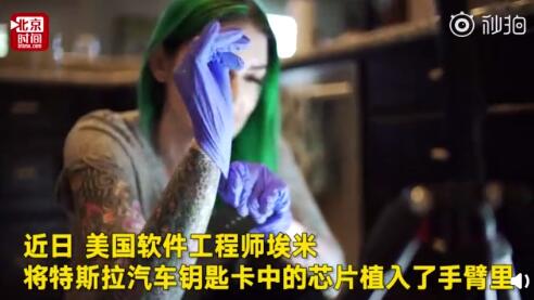 美国女子将车钥匙植入手臂 网友：要卖车咋办？