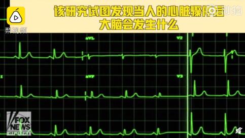 研究称人能感知自己已死亡 心脏停跳大脑仍是清醒状态