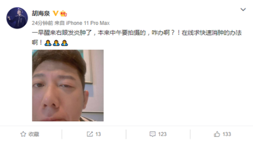  胡海泉右眼发炎红肿 紧急发文求网友支招