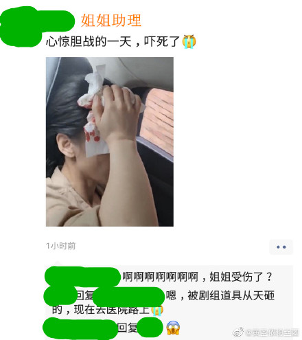 黄圣依拍戏被砸头冒鲜血 黄圣依受伤严重吗？