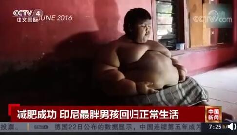 世界最胖男孩减重200斤 印尼最胖男孩减肥成功