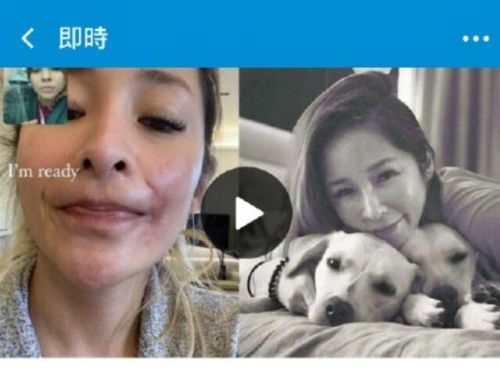 萧亚轩晒被狗咬伤疤痕照片：脸细胞坏死 还在养皮中