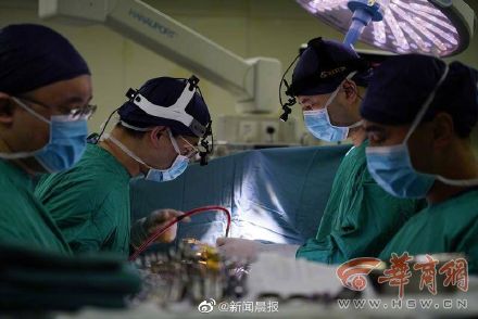全国首例心脏不停跳人工心脏植入手术成功
