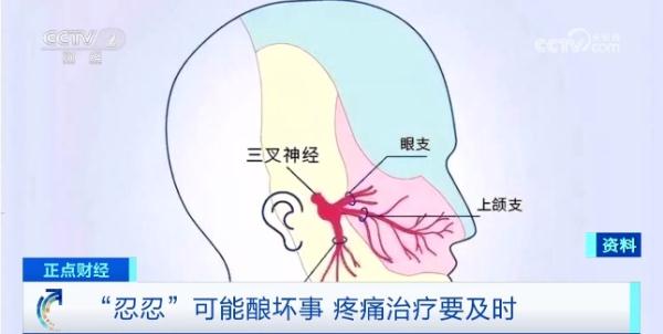 疼痛本身就是病！我国慢性疼痛患者超3亿