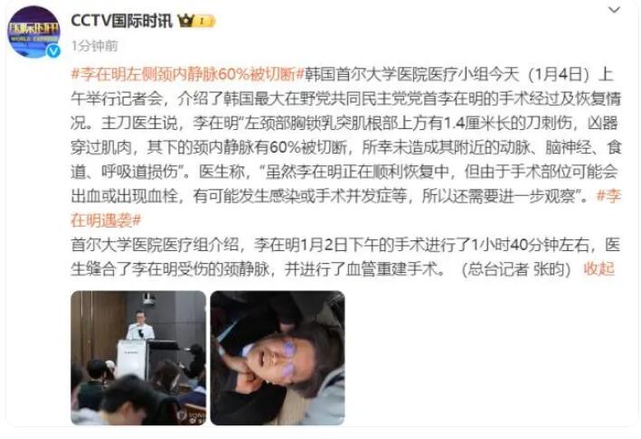 李在明左侧颈内静脉60%被切断