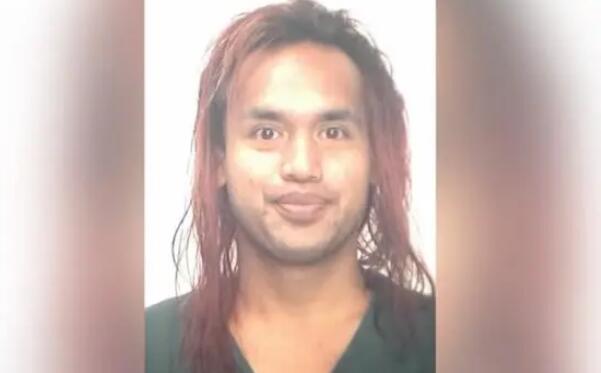在美被泼液体中国女子或永久毁容 身体大部分部位被烧伤