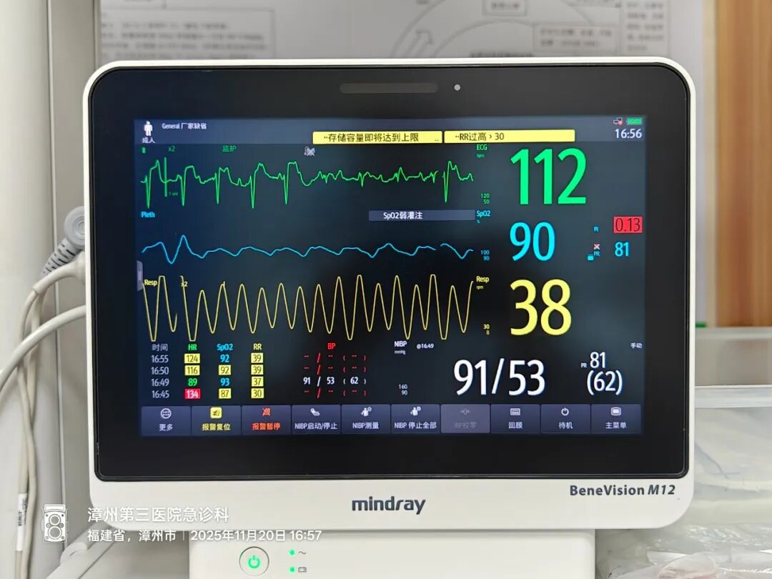 高烧不退当心EB病毒！漳州第三医院重症医学科：年轻人感冒硬扛易诱发爆发性心肌炎