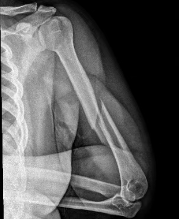 46bceed9-e3d2-4836-8dbd-e3f738351099