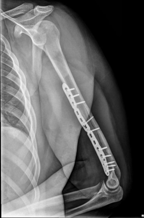 d77413f3-bdcf-4810-bf5c-32352d4ca421