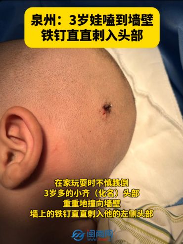 美网下注：3岁娃磕到墙壁，铁钉直直刺入头部