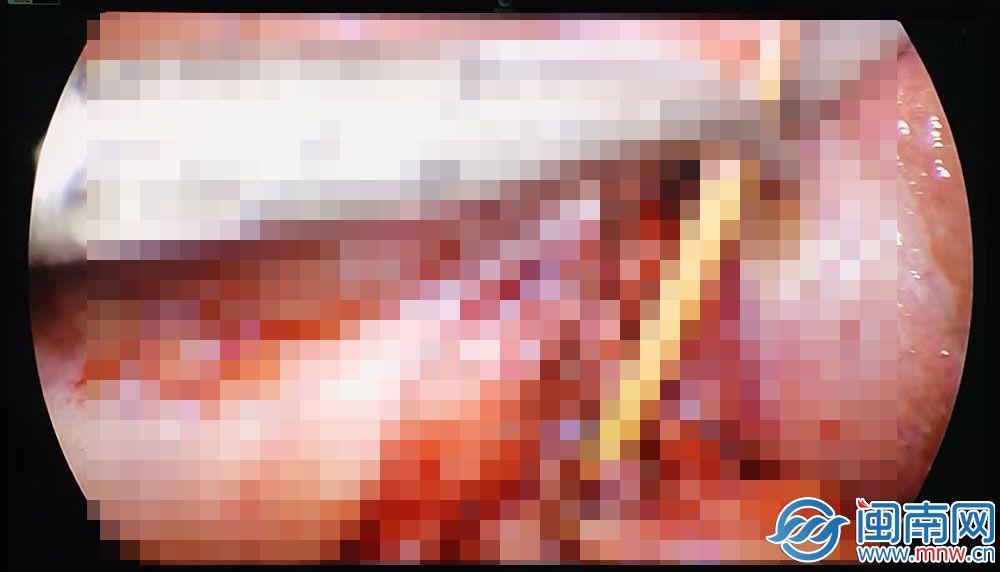 e0f71bfc-3d36-4abf-94d4-7c2178b1d1d9