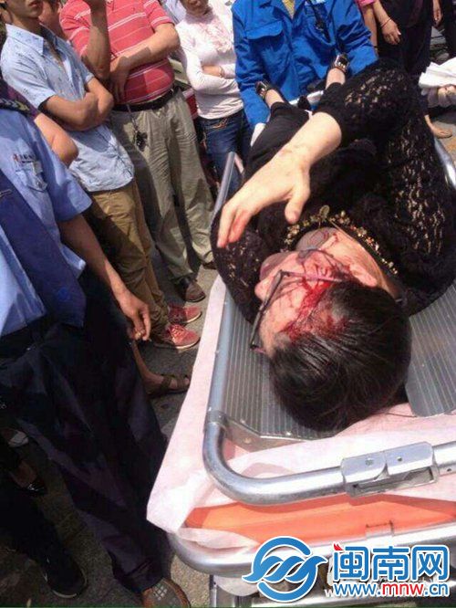 长乐业主与开发商起冲突 2女业主被钝物击破头部