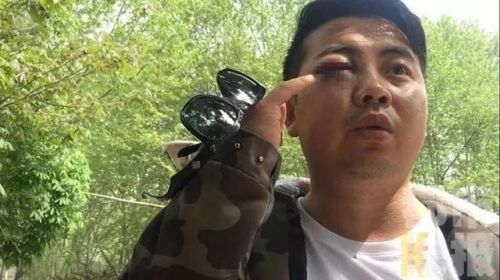 因抢了上级十来块钱的微信红包,宁陕镇政府干部小谢眼睛被打肿.