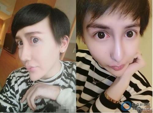 蛇精男刘梓晨小时候长这样 帅气小伙变车祸现场(图)